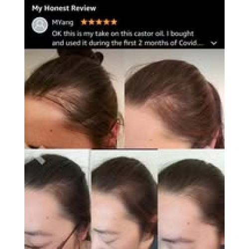 LY912 美國KATE BLANC  睫毛/毛髮增長蓖麻油60ml