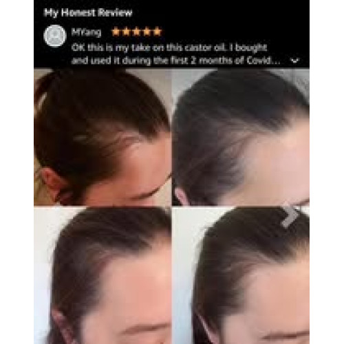 LY912 美國KATE BLANC  睫毛/毛髮增長蓖麻油60ml